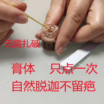 刺去猴除正品点膏痣无痕身体痣贴黑去痦痣黑子点刺神猴除器痣快膏