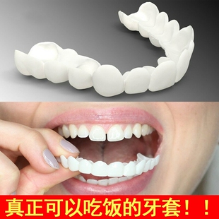 吃饭神器 成人男女通用缺牙牙缝大防塞牙遮丑硅胶套 真牙齿