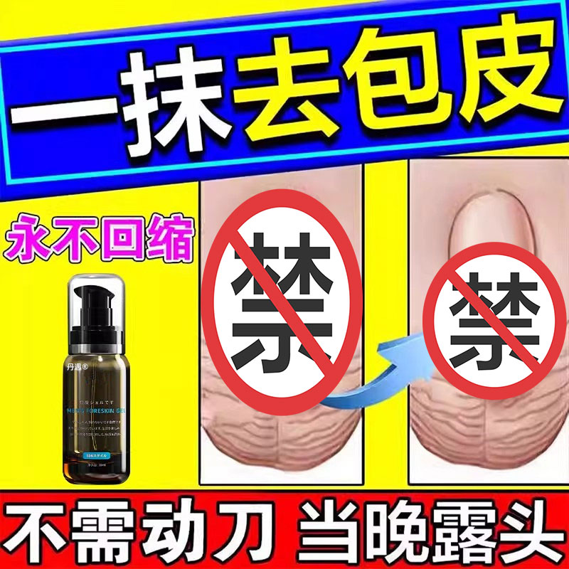 日本川井包皮阻复环外翻切除器脱落矫正男用隐形包茎凝胶医用过长