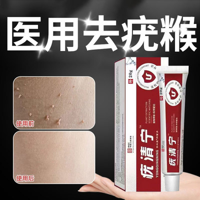 【一抹无忧】去尤膏