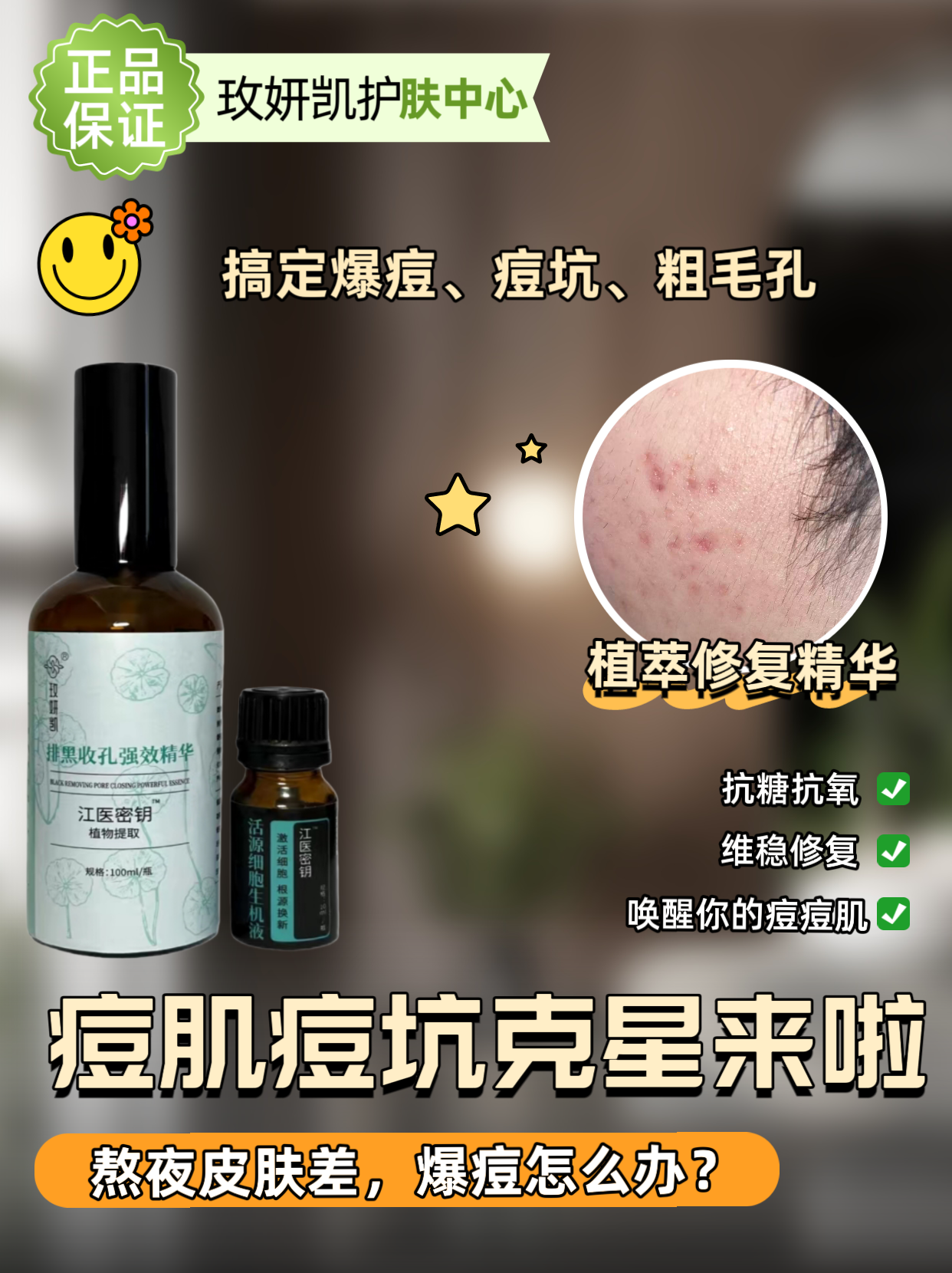 玫妍凯痘坑痘印修复精华液去黑头粉刺闭口祛痘印淡化痘印修复精华,美容护肤/美体/精油,面部护理套装,淘宝优惠券,粉丝福利购,淘宝优惠卷