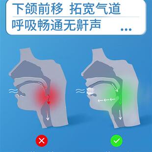 止鼾牙套神器阻止打鼾打呼噜止鼾器呼吸暂停口腔矫治器机防呼噜消