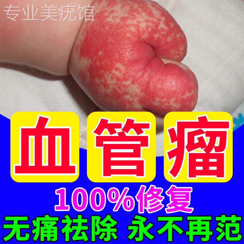 血管瘤婴儿专用药去除血管痣樱桃草莓蔓状外用瘤乳膏修复红斑血丝