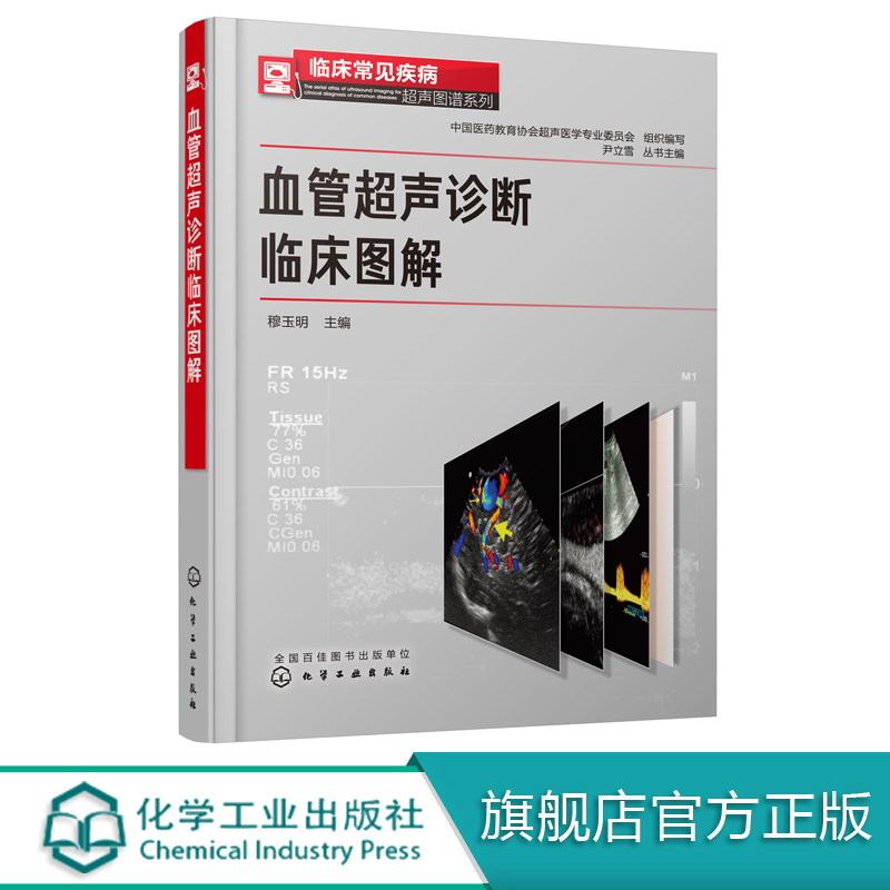血管超声诊断临床图解 穆玉明 颅脑血管 颈部血管 腹部血管 门脉系统 常见疾病诊断与治疗书籍 血管超声检查指南与读片实践