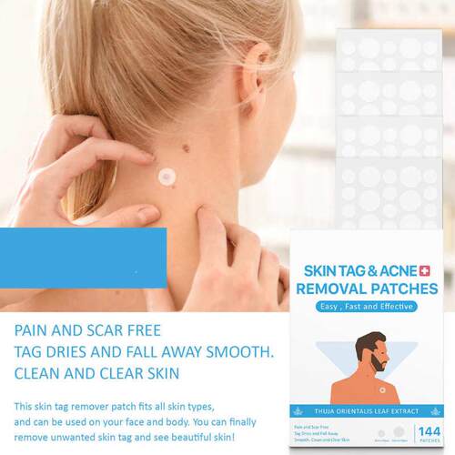 144pcs Skin Tags Moles Remover Patches Gift Wart Treatment
