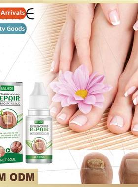 Ginger Care Patch Relieve Aches and Pains Shoulder Neck Wais