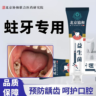 修复蛀牙龋齿牙膏神器防蛀抗敏含氟成人牙洞清理牙虫的专用药WT