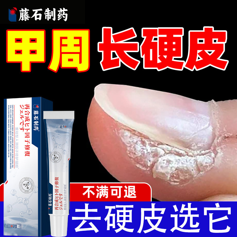 软化甲周围长硬皮膏去手指甲边缘老茧死皮角质层增厚软化剂WT