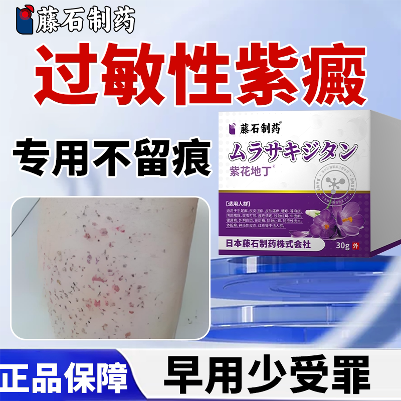 治疗过敏性紫癜皮肤凸起紫红色按压不褪色的疙瘩特效药WT