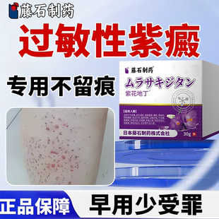 治疗过敏性紫癜皮肤凸起紫红色按压不褪色的疙瘩特效药WT