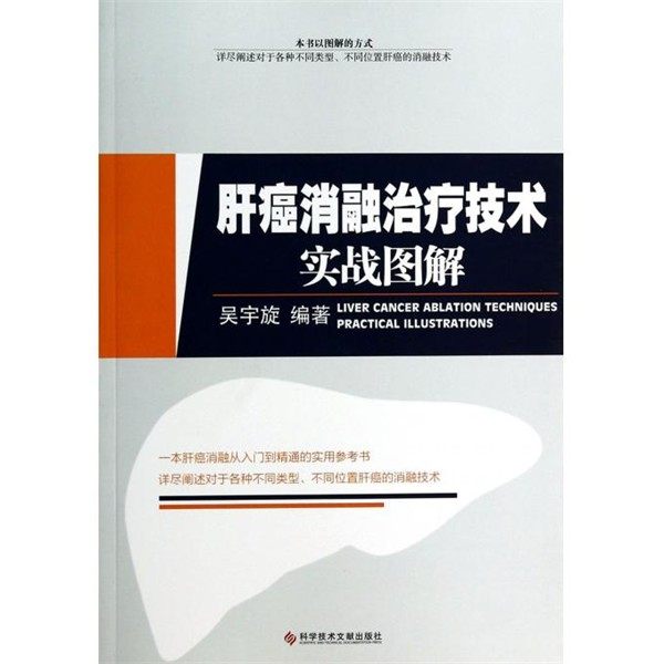 正版包邮肝癌消融治疗技术实战图解吴宇旋 编著科技文献出版社9787502378837