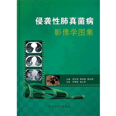 正版包邮侵袭性肺真菌病影像学图集何礼贤　等主编人民卫生出版社9787117148856