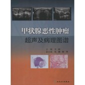 著人民卫生出版 甲状腺恶性肿瘤超声及病理图谱王彬 社9787117186445 包邮 正版