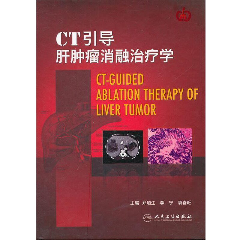 正版包邮CT引导肝肿瘤消融治疗学郑加生　等编著人民卫生出版社9787117144698