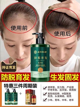 防脱洗发水排行榜第一名生发增发密发中药脱发严重女士无硅油正品