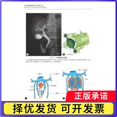肝脏疾病诊断精要(日)Etsuko Hashimoto[等]原著9787523601044中国科学技术出版社有限公司书籍\/杂志\/报纸/医学卫生/内科学
