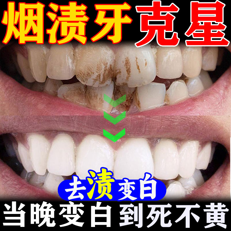 强力去烟渍牙膏去牙结石茶牙牙膏溶解牙石美白专用去牙垢黄牙结石