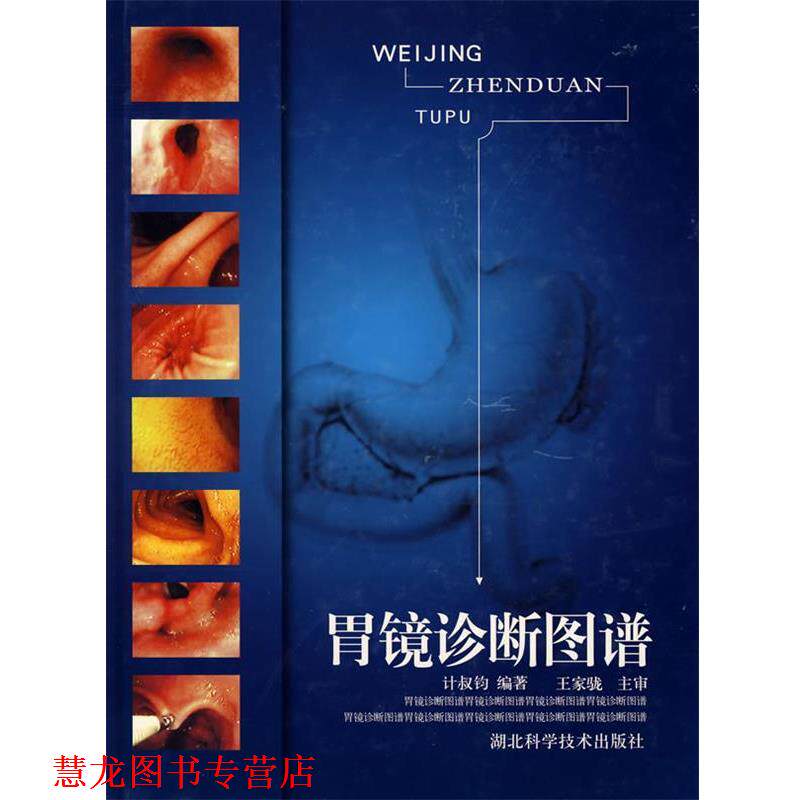 【正版书籍】 胃镜诊断图谱 计叔钧 编著 湖北科学技术出版社