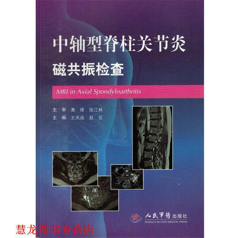 【正版书籍】 中轴型脊柱关节炎磁共振检查 王炎焱, 赵征, 主编 人民军医出版社