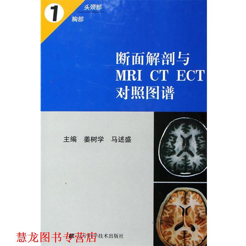 【正版书籍】 断面解剖与MRI CT ECT对照图谱1 姜树学,马述盛 主编 辽宁科学技术出版社