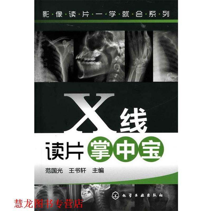 【正版书籍】 影像读片一学就会系列--X线读片掌中宝 范国光,王书轩 主编 化学工业出版社