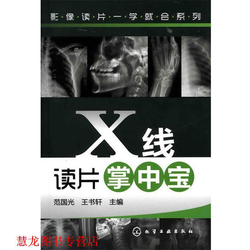 【正版书籍】 影像读片一学就会系列--X线读片掌中宝 范国光,王书轩 主编 化学工业出版社