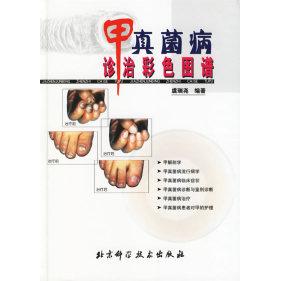 【正版图书】甲真菌病诊治彩色图谱虞瑞尧著北京科学技术出版社