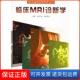 梁碧玲广东科技出版 临床MRI诊断学孟悛非 社9787535938794 保正版