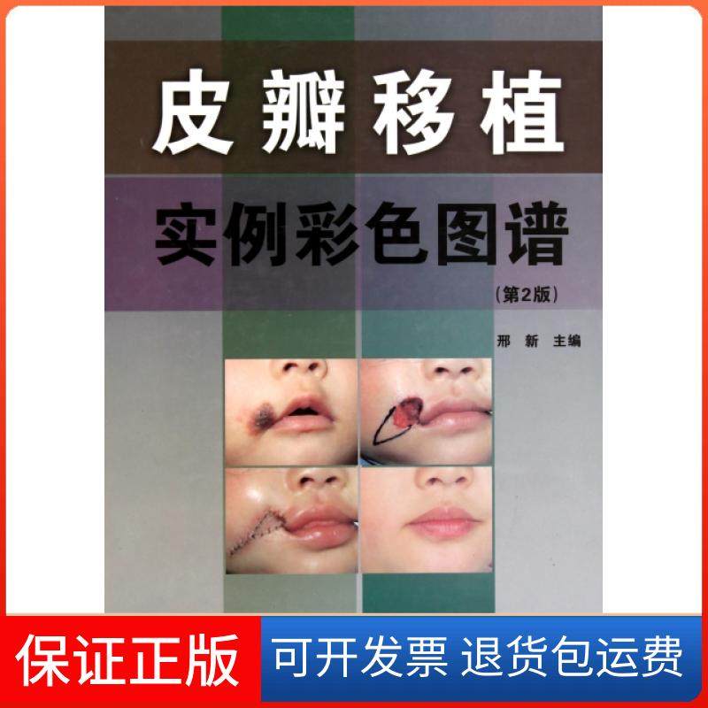 【保正版】皮瓣移植实例彩色图谱(第2版)(精)邢新辽宁科技9787538168174