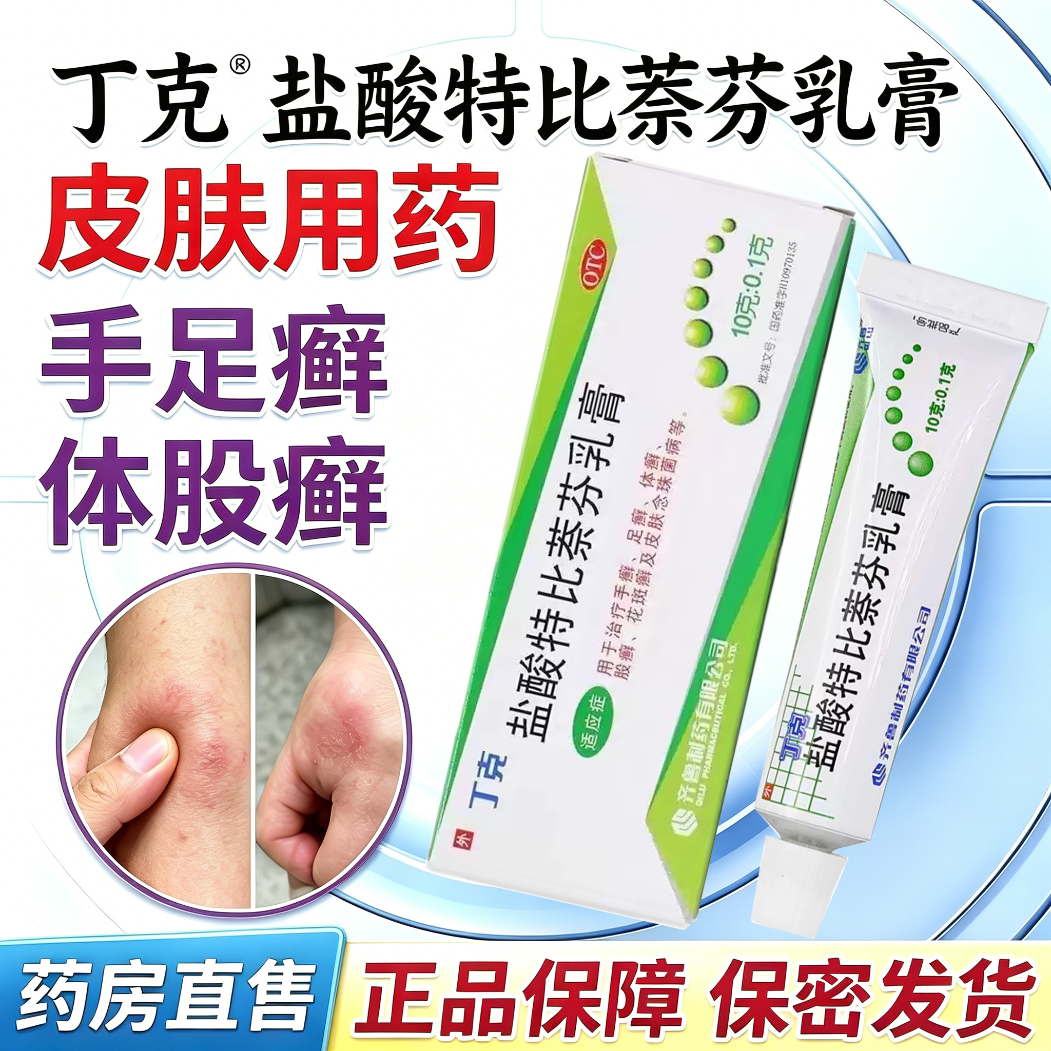 丁克盐酸特比萘芬乳膏10g治疗手足癣体股癣花斑癣及皮肤念珠菌