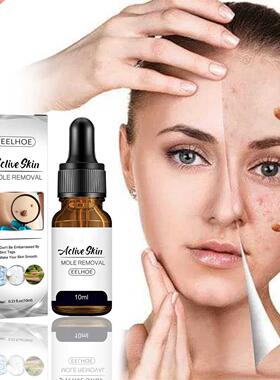 Free Shipping Wart Treatment Wart Removal Essence Neck Skin