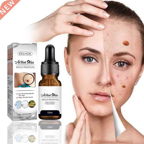 Free Shipping Wart Treatment Wart Removal Essence Neck Skin