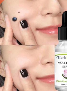 Skin Tag Removal Solution Painless Mole Skin Dark Spot Remov