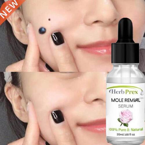Skin Tag Removal Solution Painless Mole Skin Dark Spot Remov