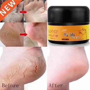 Horse Oil Feet Care Cream Beriberi Cream for Athlete's Foot