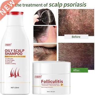 Hair Psoriasis Seborrheic Skin Care Treatment Dermatitis Ecz