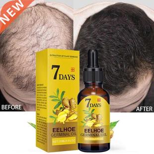 Fast Oil Growing Products Ginger Growth Essential Hair