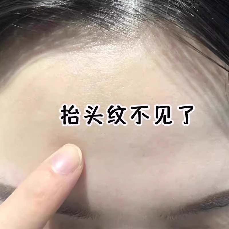 官方正品~抬头纹救星 胶原川字纹额头抗皱神器 男女通用