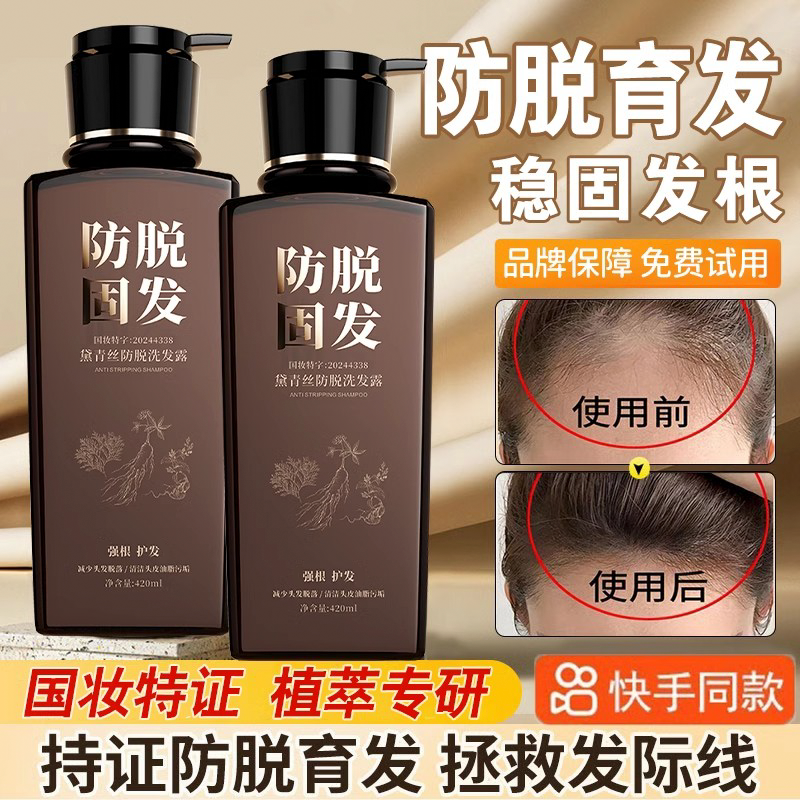 黛青丝防脱洗发露育发固发根