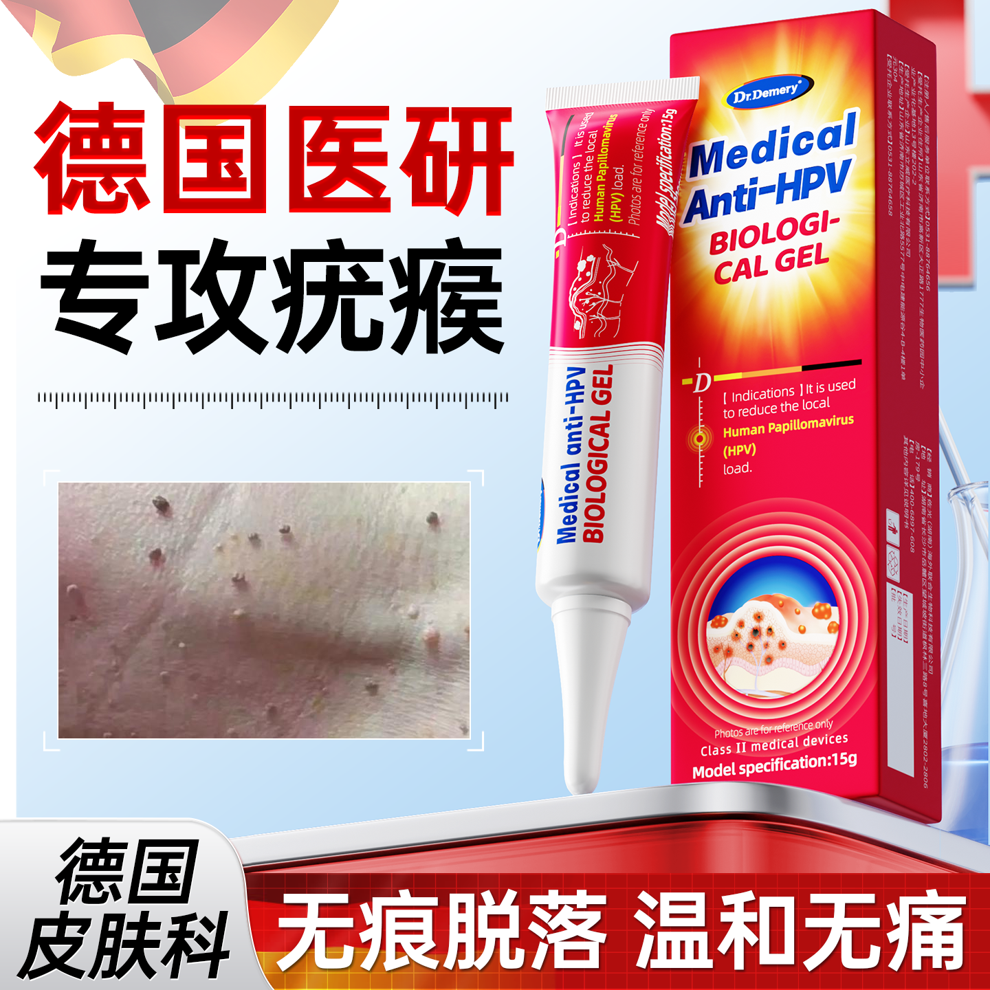 【德国技术】无痛脱疣瘊