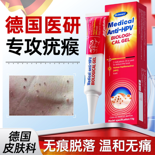 【德国技术】无痛脱疣瘊