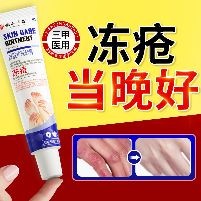 医用冻疮膏止痒冻伤特效防冻防裂儿童耳朵脚后跟手干裂正品修复霜,保健用品,皮肤消毒护理（消）,淘宝优惠券,粉丝福利购,淘宝优惠卷