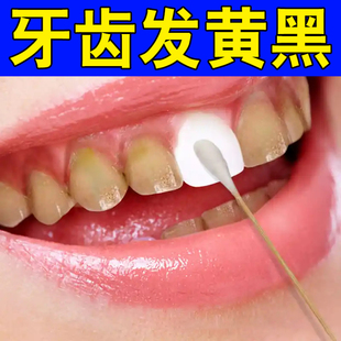 牙斑净牙根发黑牙黄牙垢茶渍牙斑净牙缝发黑清理牙菌斑