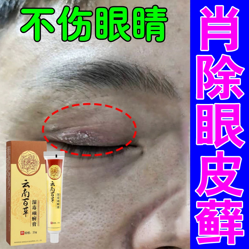 眼皮痒眼睛周围眼角痒干燥起皮掉屑眼皮干痒眼周红肿起皮脱皮软膏