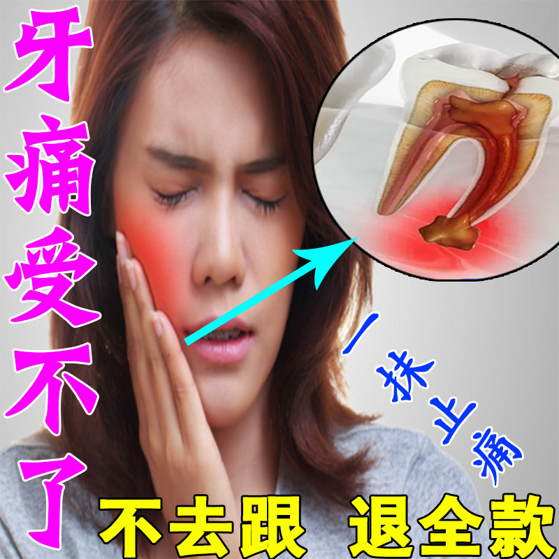 牙痛牙疼止疼喷雾杀死牙神经速效牙龈肿痛消炎药水治儿童蛀牙虫牙