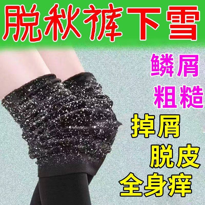 小腿秋冬天皮肤干燥起皮掉皮屑腿部皮肤干燥鱼鳞补水保湿修复润肤