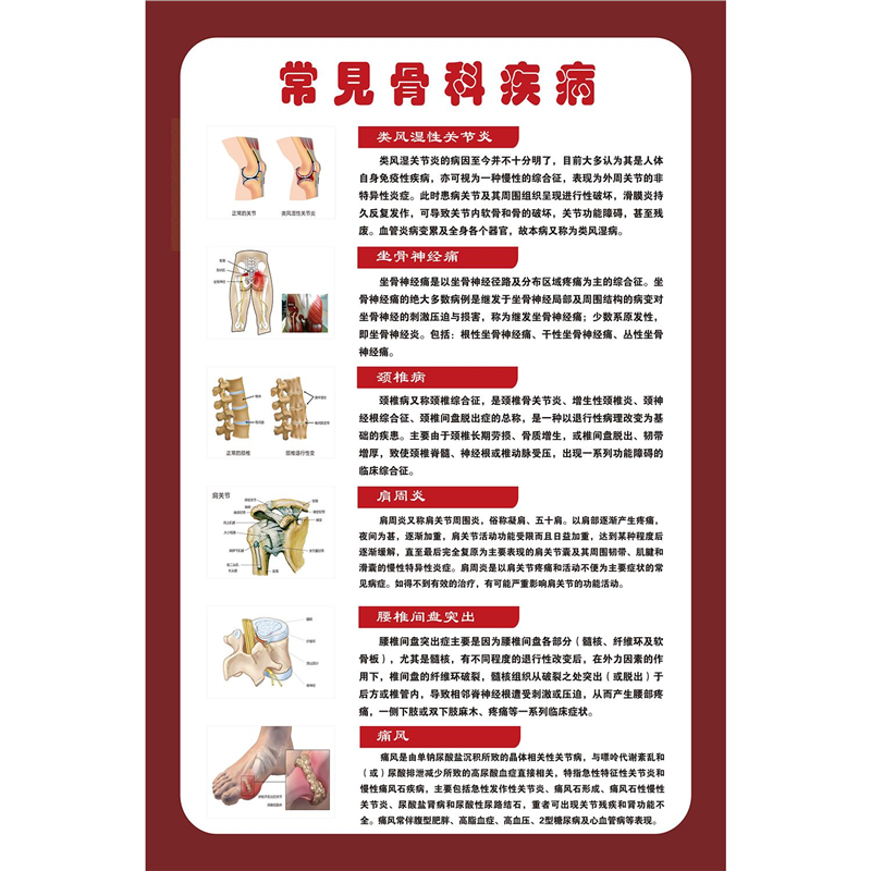 骨科常见疾病图谱医学海报挂图人体骨骼结构展板写真解剖海报