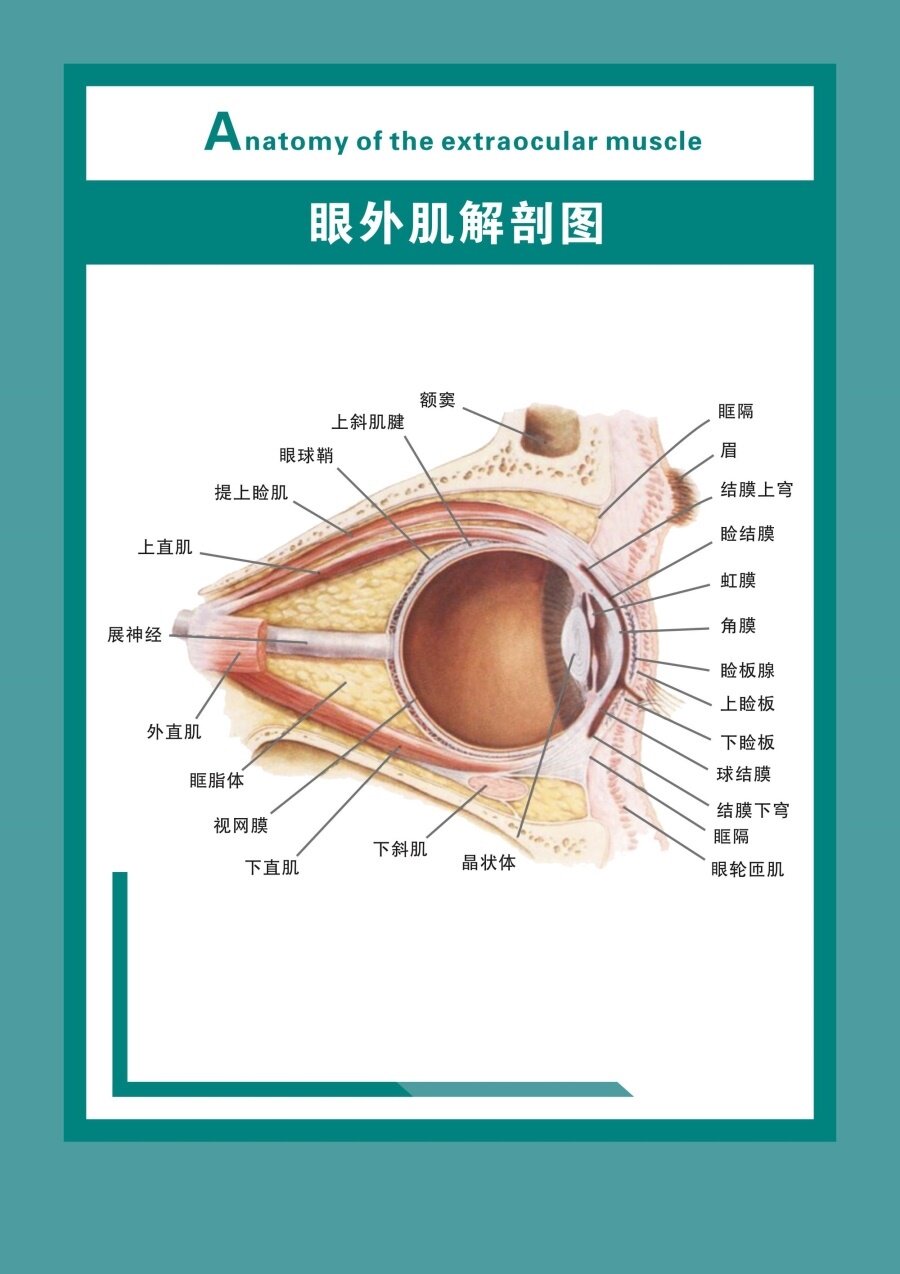 眼外肌解剖图海报眼球血管解剖图墙贴纸眼底示意图kt板