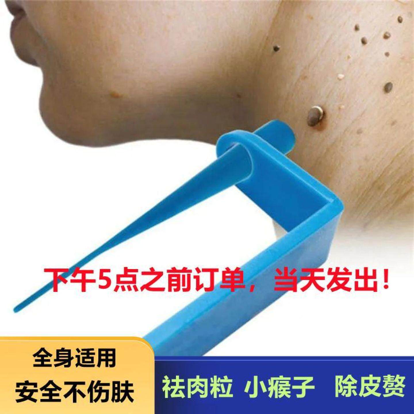 肉赘去除神器物理祛猴子脖子长小肉粒疙瘩腋下痦子去除皮赘器套装