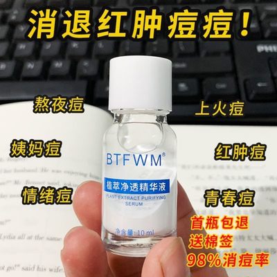 男女快速催熟去青春豆闭口粉刺青春痘痤疮去红肿粉刺消炎淡化痘印